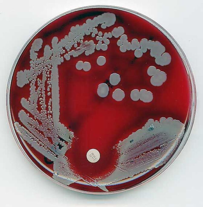 The bacteria behind staph infections.