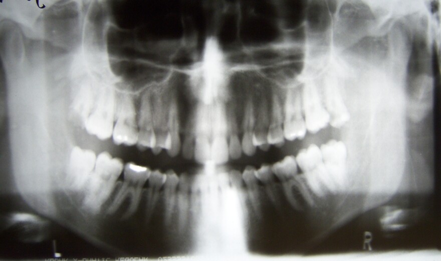 A dental X-ray.
