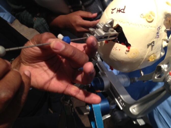 Phantom skull used in virtual surgery