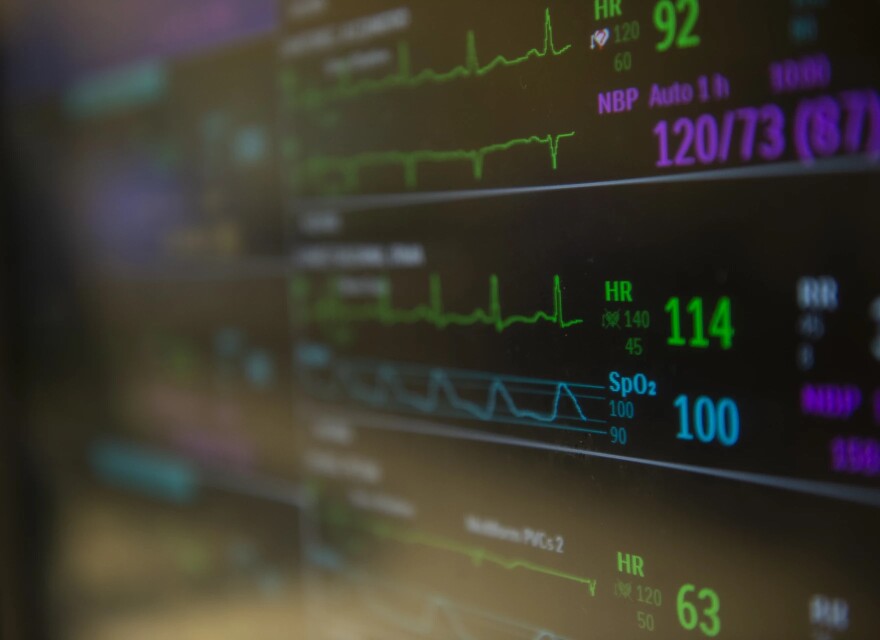 A heart monitor chart with a dark background showing vital signs.