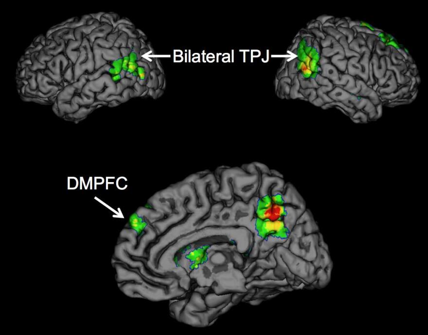 Psychologists report for the first time that the temporoparietal junction (TPJ) and dorsomedial prefrontal cortex (DMPFC) brain regions are associated with the successful spread of ideas, often called 'buzz.'