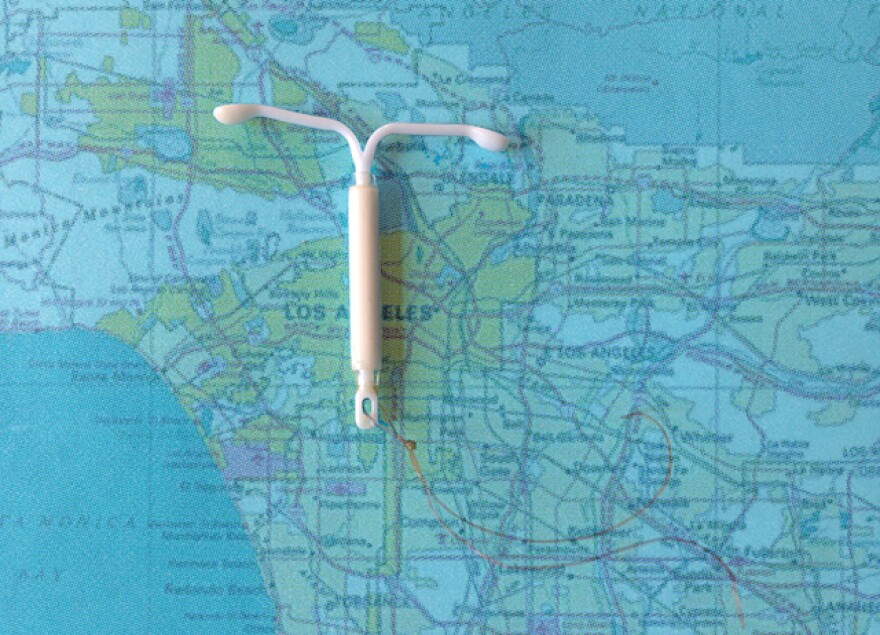 iud.jpg