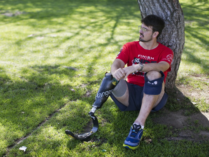 Damian Kevitt spent four months in the hospital, including his right leg amputation, skin grafts and other surgeries.