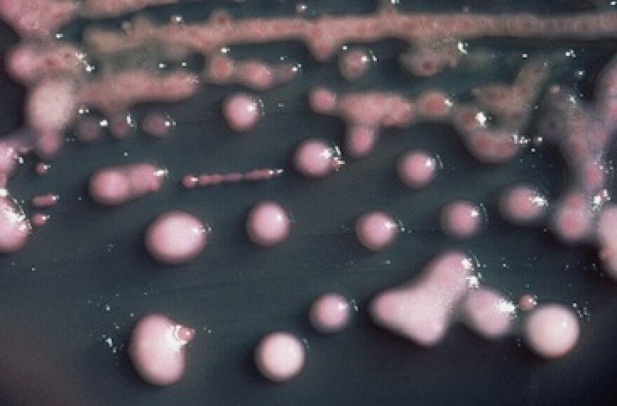 Klebsiella_pneumoniae.jpg