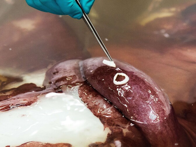 The giant squid was discovered in Antarctica's Ross Sea by a fisherman.