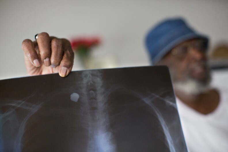 Charles Beatty holds an X-Ray of the bullet that is still lodged near his spine 15 years after being shot in the back by police in June 2000.