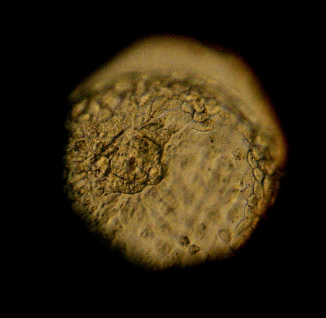 LA JOLLA, CA - FEBRUARY 28:  A donated human embryo is seen through a microscope at the La Jolla IVF Clinic February 28, 2007 in La Jolla, California. The clinic accepts donated embryos from around the country through The Stem Cell resource which are then given to stem cell research labs for research.  (Photo by Sandy Huffaker/Getty Images)