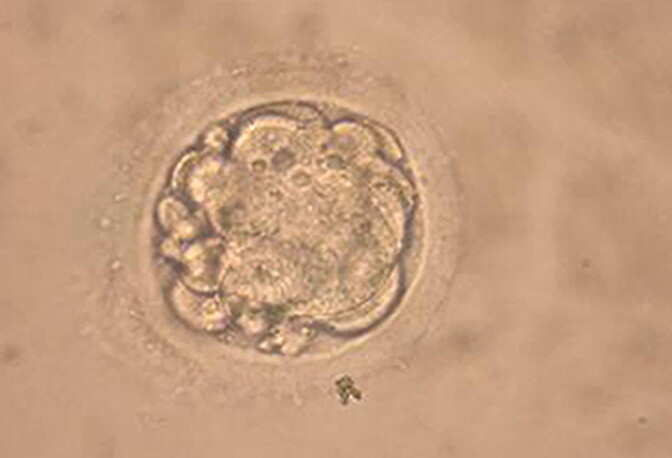 SEOUL, SOUTH KOREA - FEBRUARY 12: This undated microscopic photo shows a cloned human embryo used to generate stem cells during an experiment in Seoul. South Korean researchers said they had cloned a human embryo February 12, 2004 and extracted embryonic stem cells from it.  (Photo by Seoul National University/Getty Images)