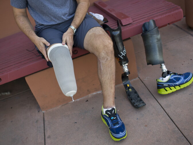 Damian Kevitt puts on his running leg on Tuesday, March 10, 2015 before a run at Griffith Park. Kevitt started training with his new running leg in August 2014.