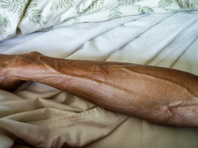 "I've always been told I have a remarkable body. Now I have lipodystrophy, the absence of body fat. It's a side effect of my AIDS drugs. In my photographs, I tried to capture some of my body topography. I'm not defined by HIV. I don't consider myself a victim. I consider myself very much alive and resilient." –Guillermo, Los Angeles, 2011