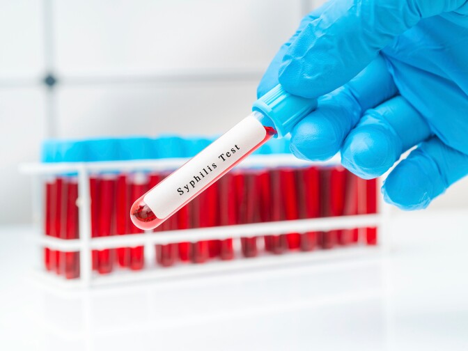 Syphilis cases in California have contributed to soaring national caseloads of sexually transmitted diseases. Experts point to the advent of dating apps, less condom use and an increase in meth.