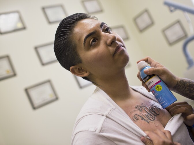 Liliana Flores, 19, finishes a tattoo removal session at Homeboy Industries on Wednesday afternoon, April 15, 2015. More than a year after being released from juvenile prison, Flores is now a student at Pierce College.