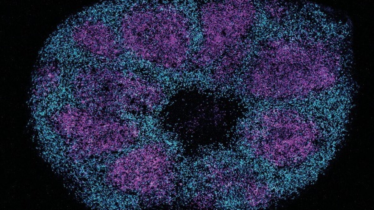 Proteins linked to autism