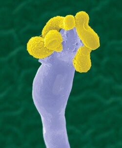 This false-color electron microscope image catches the fungus Cryptococcus gatii in the act of producing its infectious spores.