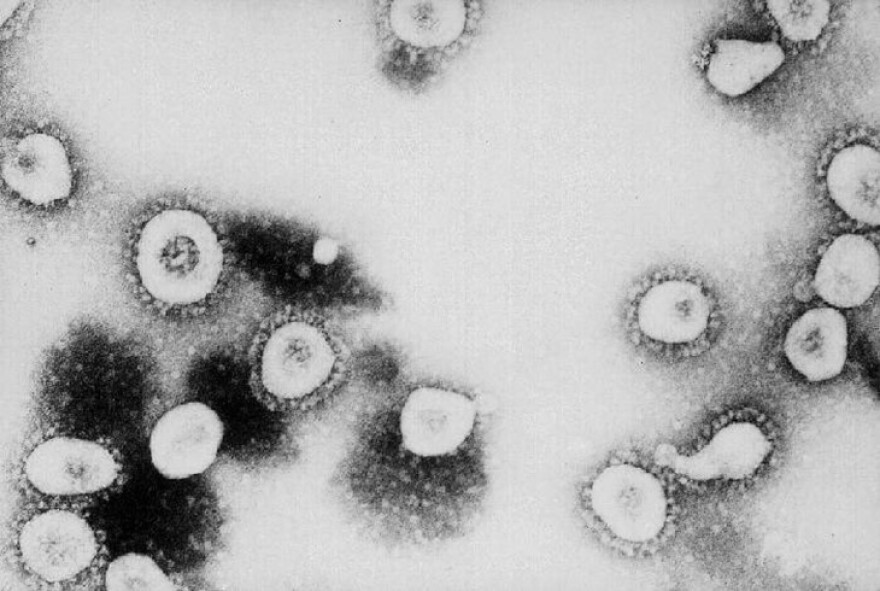 A photo showing a microscopic view of the new Coronavirus.