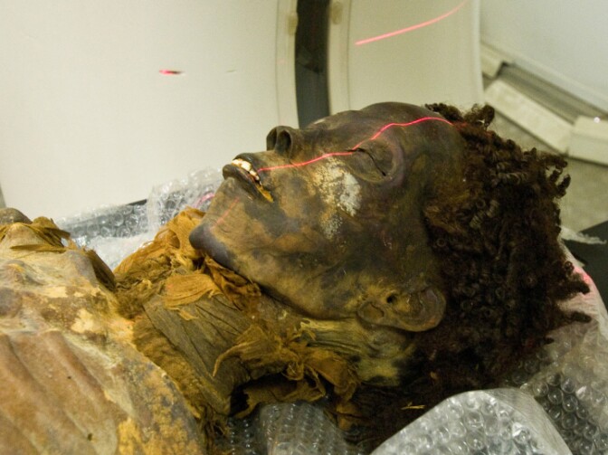 The mummy Maiherpri undergoes CT scanning. Study results call into question the perception of atherosclerosis as a modern disease.