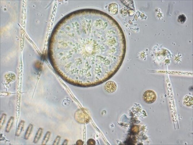 An example of phytoplankton as photographed by researchers at the University of Southern California. 
