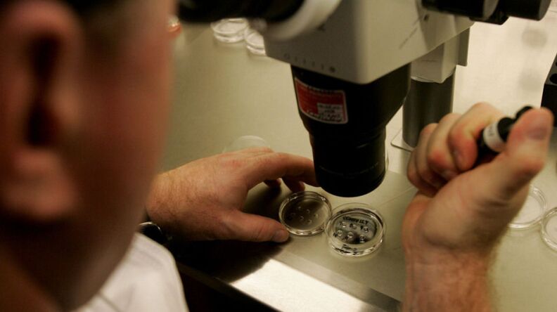 Human embryos under a microscope at an IVF clinic in La Jolla, Calif.