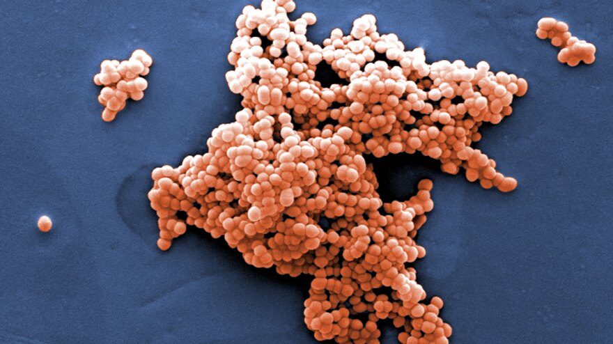 Streptococcus bacteria, like this strain, can be found in our guts.