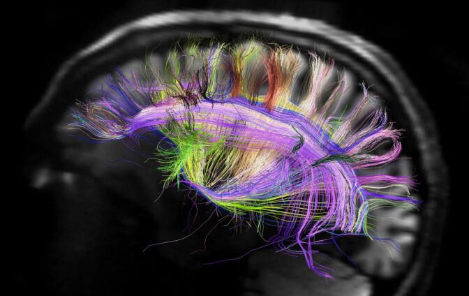 This image shows the grid structure of the major pathways of the brain. It was created using a scanner that's part of the Human Connectome Project, a five-year effort which is studying and mapping the human brain.
