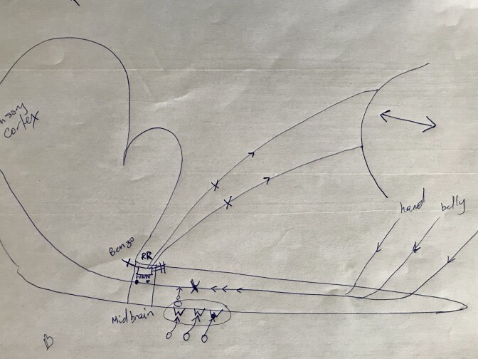 Dr. Andrew Germanovich's drawing depicts how opioids interact with the brain function. He draws it for all new patients.