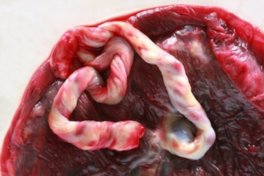 humanplacenta.jpg