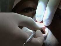 7-year-old Darrien Ryan gets his teeth cleaned. Darrien said after this he was considering being a dentist when he grew up because it seemed so cool.