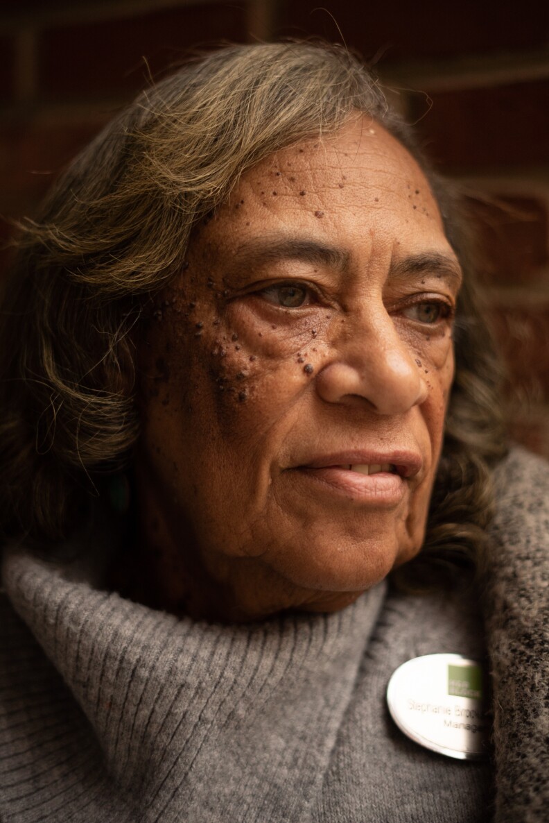 A photo of a woman with gray hair and moles on her face staring off to the side.