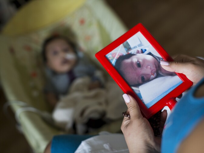 Araceli Viveros holds a photograph of her newborn son taken in December 2014. Her son had jaw problems when he was born and had to undergo surgery.