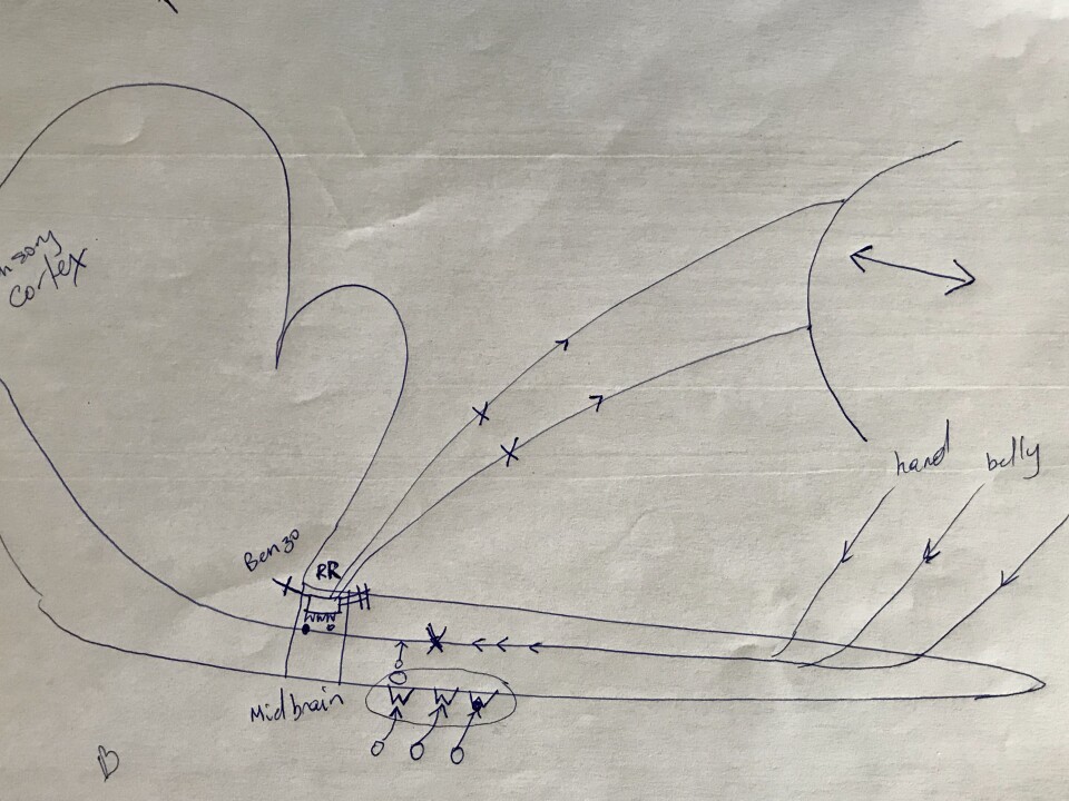 Dr. Andrew Germanovich's drawing depicts how opioids interact with the brain function. He draws it for all new patients.