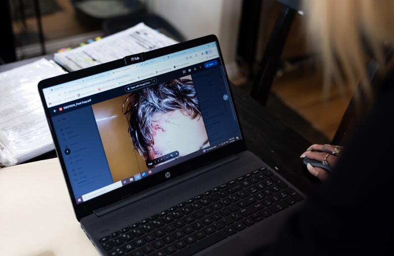 An open laptop with a close up photo of a various stitches on a forehead.