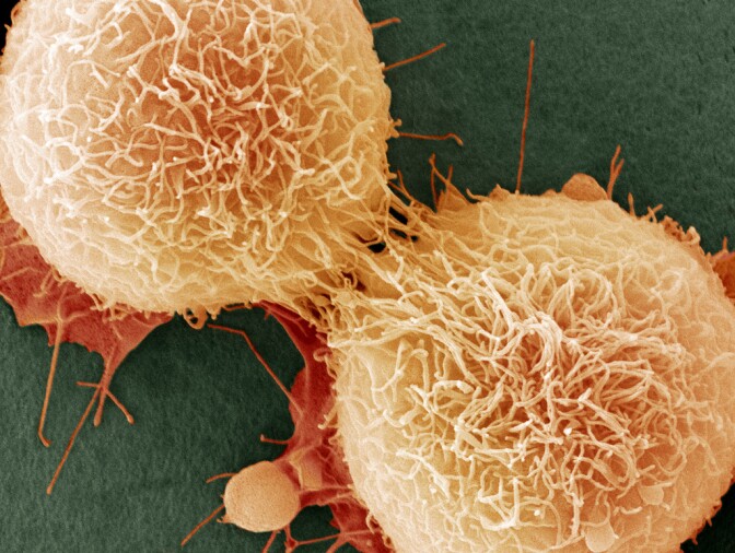 A close-up of cell mutations that cause cancer.
