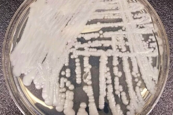 a white fungus grows in a petri dish on a countertop