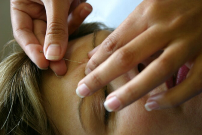 Students practice acupuncture.