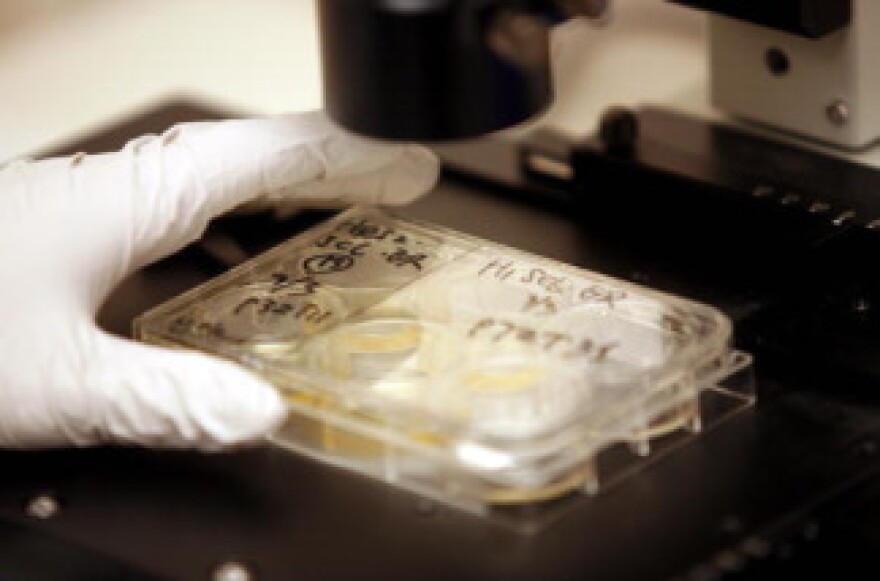 Kejin Hu, a research associate, looks at a colony of human embryonic stem cells under a microscope at the Wisconsin National Primate Research Center at University Wisconsin-Madison March 10, 2009 in Madison, Wisconsin.