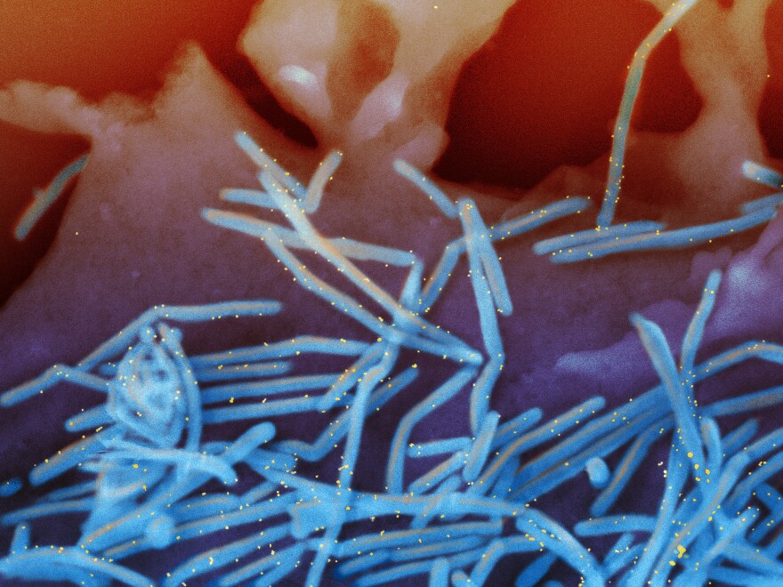 A colorized image from an electron micrograph shows a mass of what look like overlapping blue sticks, some bent but mostly straight, on a nondescript reddish background. Little yellow specks or dots appear mostly on or over the sticks, but some on their own.
