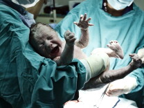Pregnant doctors are less likely than other women to deliver their babies via C-section, recent research suggests. Economists say that may be because the physician patients feel more empowered to question the obstetrician.