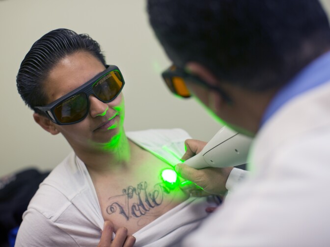 Liliana Flores, 19, goes through a tattoo removal session at Homeboy Industries on April 15, 2015. Flores has tattoos on her arms, chest, neck and hands that will take several sessions to remove.