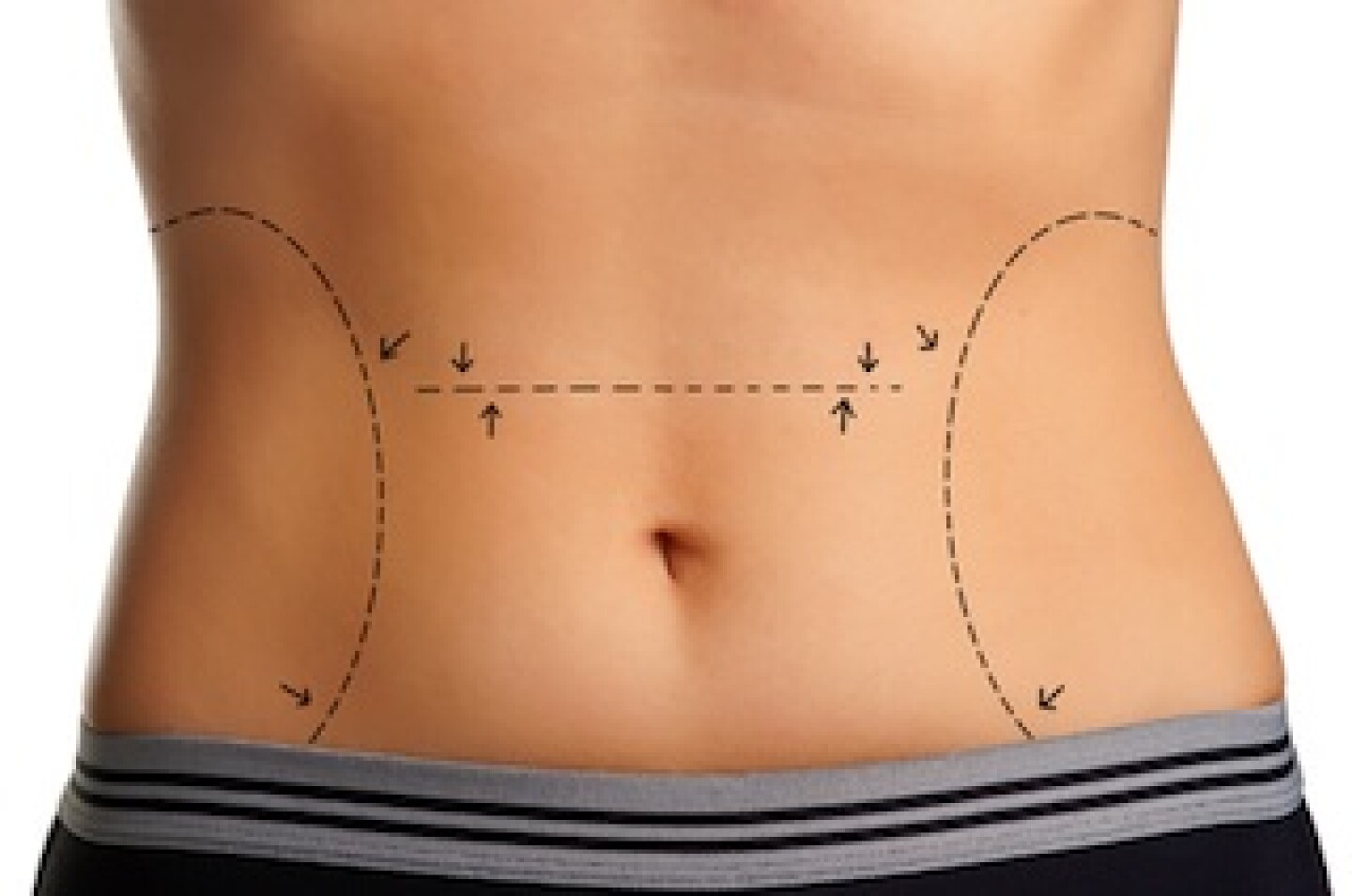 lipo-surgeon.jpg