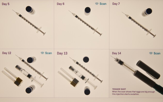 Some of the equipment required for one cycle of in vitro fertilisation (IVF), are seen on display as part of an exhibition 'IVF: 6 Million Babies Later' at the Science Museum in London on July 23, 2018 during an event to mark 40 years since the pioneering birth of Louise Brown the world's first IVF baby. - July 25, 2018 is the 40th birthday of Louise Brown, the world's first "test tube baby" who was born at Oldham General Hospital on July 25, 1978 after her parents Lesley and John became the first people to successfully undergo in vitro fertilisation (IVF). Louises birth created controversy, but also paved the way for millions IVF births across the world over the next four decades and won Robert Edwards, one of the developers of the treatment, the Nobel Prize in Physiology or Medicine. (Photo by Daniel LEAL-OLIVAS / AFP)        (Photo credit should read DANIEL LEAL-OLIVAS/AFP/Getty Images)