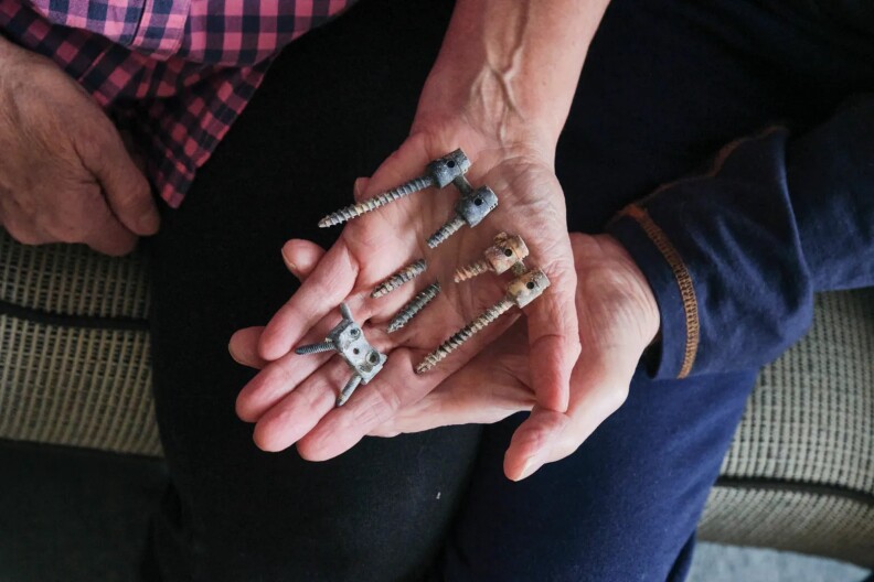 Two open-faced hands holding broken screws.