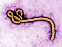 UNDATED:  In this handout from the Center for Disease Control (CDC), a colorized transmission electron micrograph (TEM) of a Ebola virus virion is seen. As the Ebola virus continues to spread across parts of Africa, a second doctor infected with the disease has arrived in the U.S. for treatment.  (Photo by Center for Disease Control (CDC) via Getty Images)