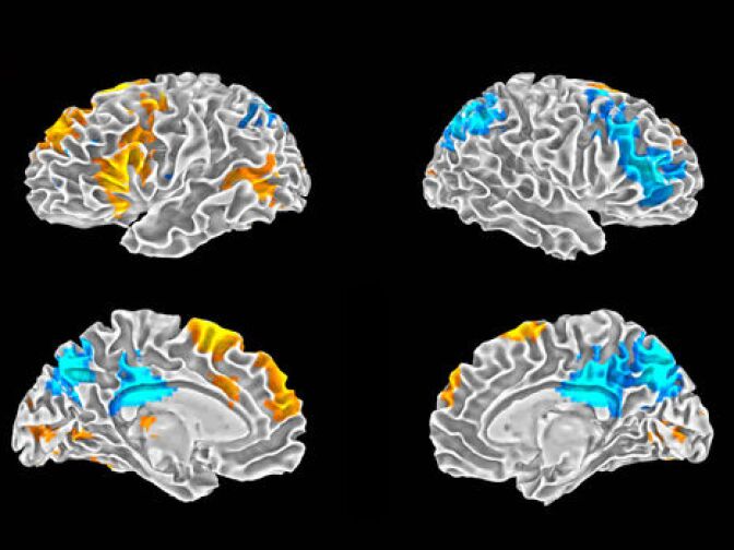 Image of a brain scan taken during the rap study. The orange colors show the parts of the brain that are active when a rapper is improvising. The blue areas show activity when the rapper is performing a rap from memory.