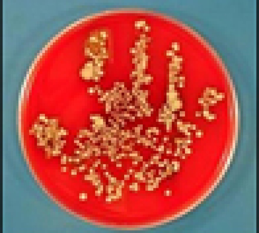 Cedars-Sinai's Hand Washing poster