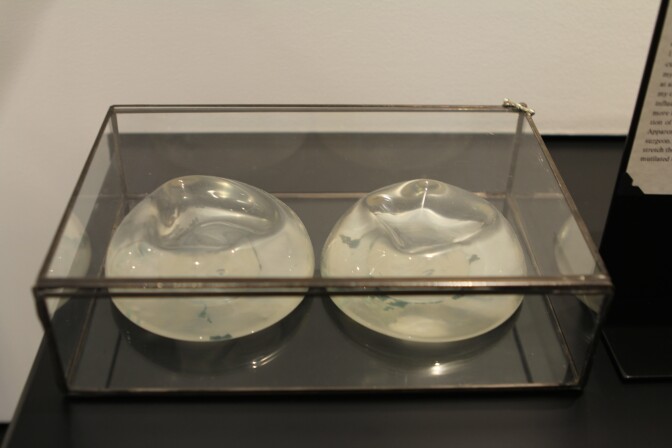 Breast implants that were removed after a breakup sit on display at the Museum of Broken Relationships in Los Angeles, Calif. 