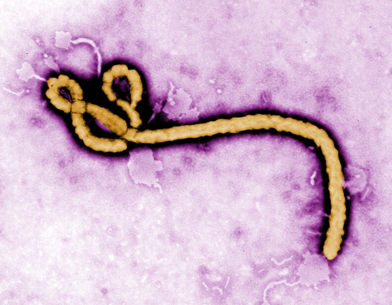 UNDATED:  In this handout from the Center for Disease Control (CDC), a colorized transmission electron micrograph (TEM) of a Ebola virus virion is seen. As the Ebola virus continues to spread across parts of Africa, a second doctor infected with the disease has arrived in the U.S. for treatment.  (Photo by Center for Disease Control (CDC) via Getty Images)