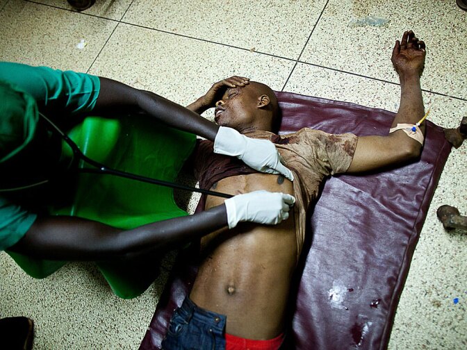 A doctor treats a victim at Mulago hospital in Kampala late Sunday after twin bomb blasts tore through crowds of soccer fans watching the World Cup final. The country's police chief said the blasts at an Ethiopian-owned restaurant and a rugby club in Kampala were a terrorist attack by the Somali militant group al-Shabab.