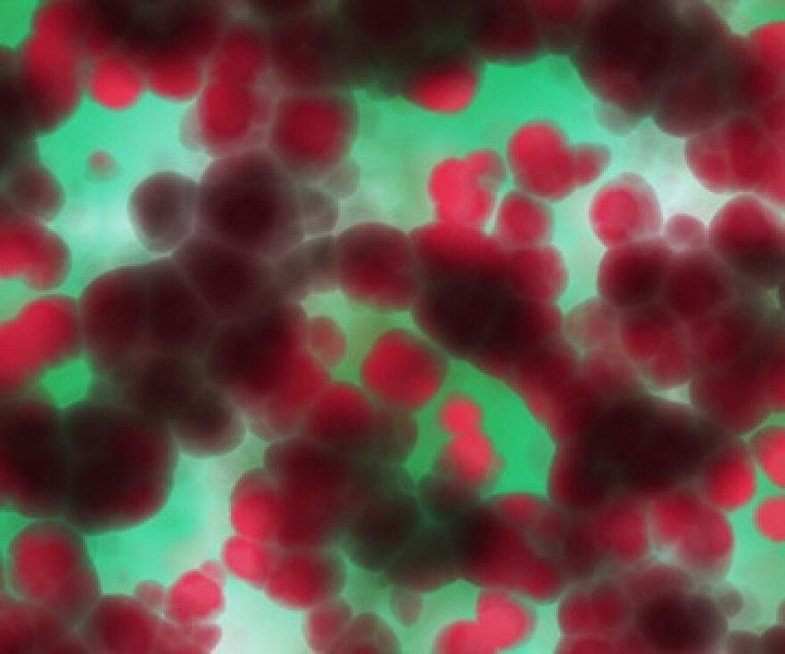 bacterial-cells-shutterstock.jpg