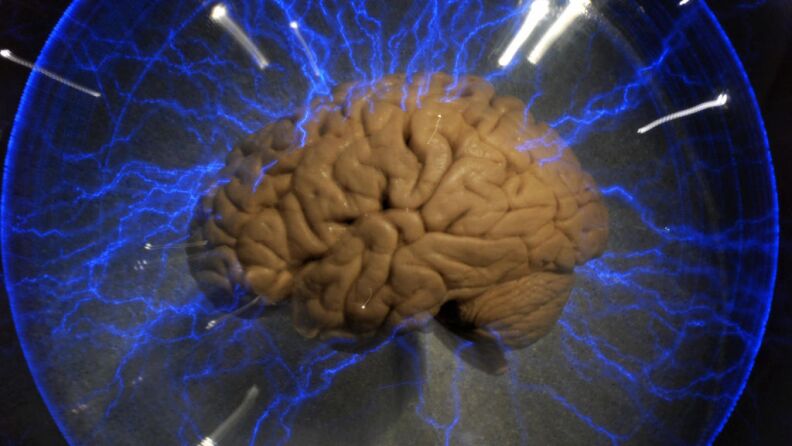 The human brain.