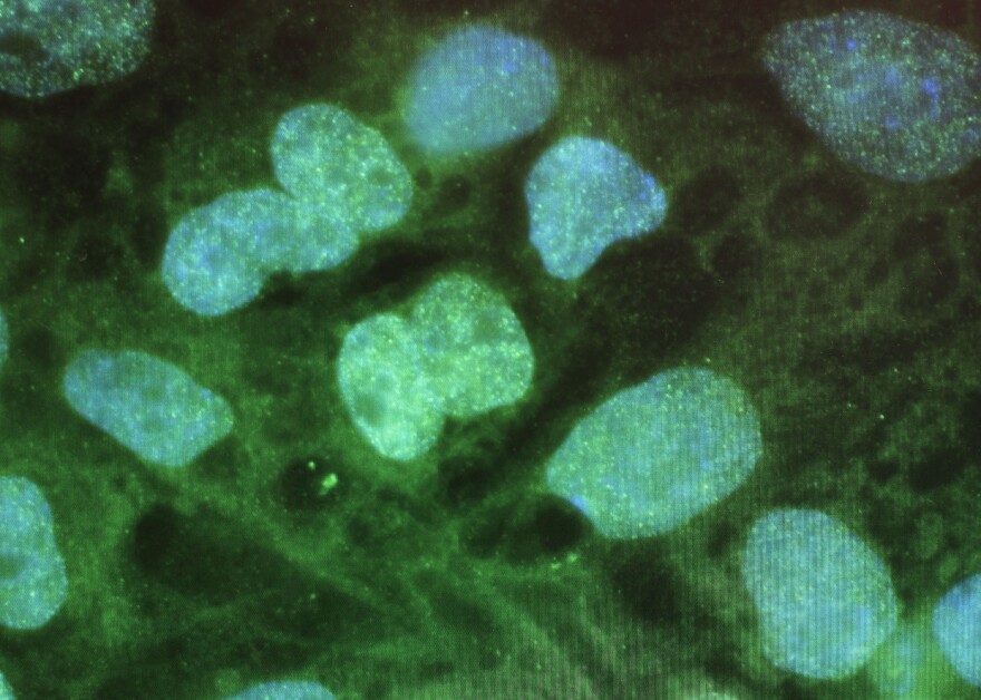 FARMINGTON, CT - AUGUST 27: Stem cells are viewed on a computer screen at the University of Connecticut`s (UConn) Stem Cell Institute at the UConn Health Center on August 27, 2010 in Farmington, Connecticut. UConn scientists and students have been recipients of federal grants for work using human embryonic stem cells and could be  significantly affected by a federal court ruling that would limit funding for embryonic stem cell research. On August 23, U.S. District Judge Royce C. Lamberth issued a preliminary injunction in Washington, D.C., halting all federal funding for basic research into embryonic stem cell technology. Stem cell research is believed to offer great hope in finding treatments to many diseases and illnesses including heart attacks, strokes and spinal cord injuries.   (Photo by Spencer Platt/Getty Images)